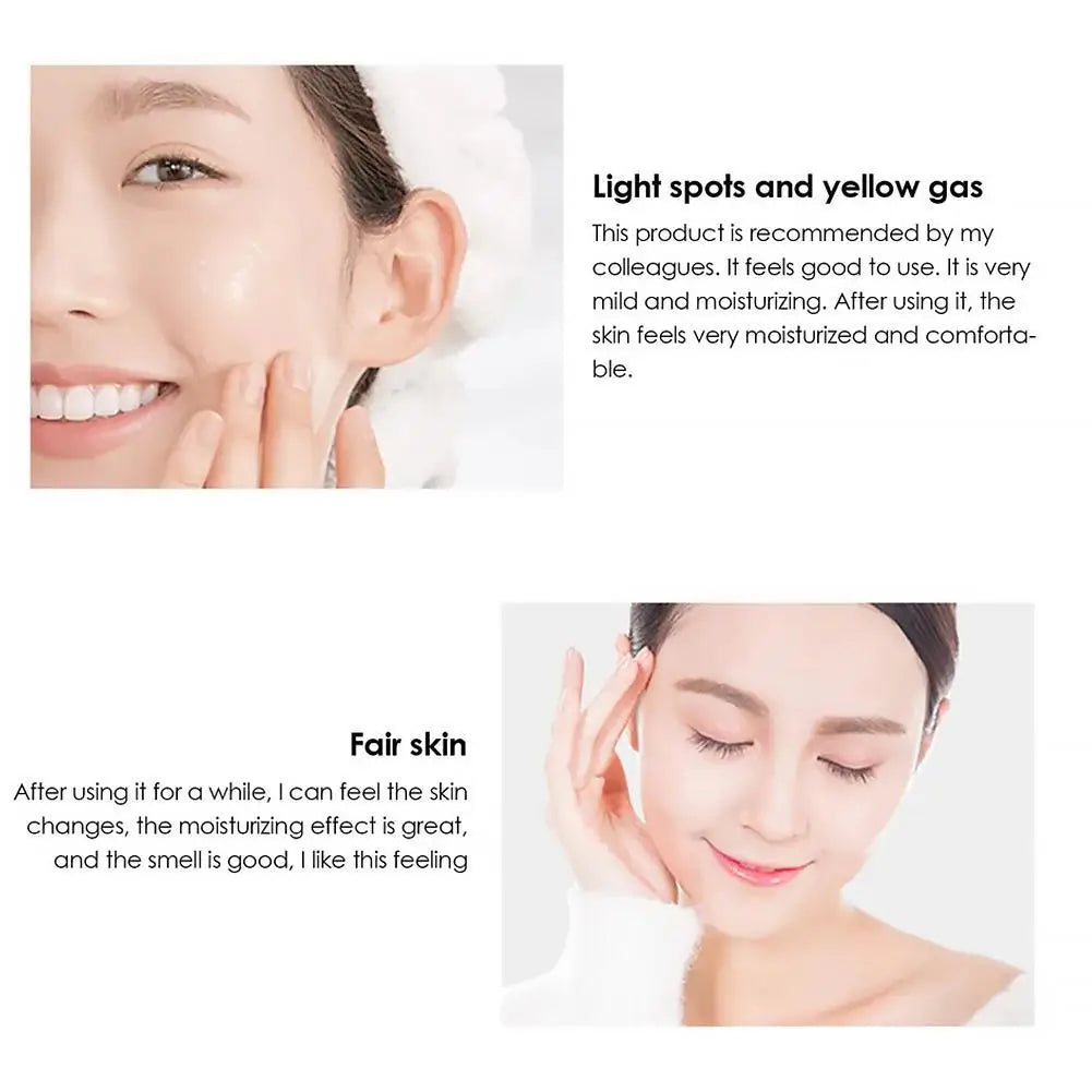 Whitening Cream Anti Freckle Face Cream, Remove The Black,Melasma Dark Spot Acne Deposits On The Skin,Brighten Skin Care